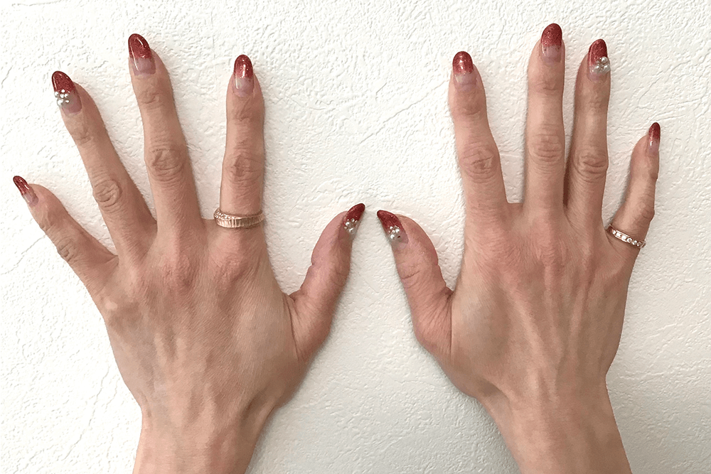 人差し指と小指に指輪を着けるイメージ